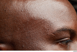 HD Face Skin Izik Wangombe eye face forehead skin pores…